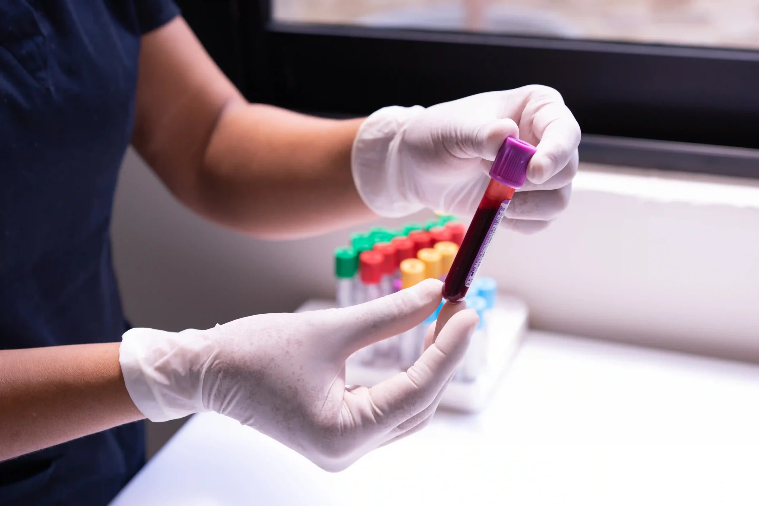 profissional de saúde segurando tubo de coleta de sangue para análise relacionada à saúde metabólica